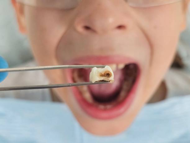 Best Emergency Dentist for Special Needs Patients in Chincoteague, VA